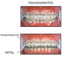 brackets invisibles